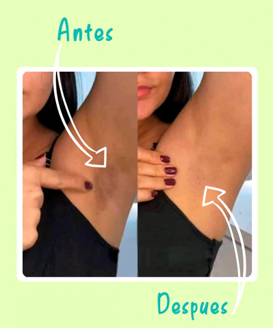 SERUM DESPIGMENTANTE Y ACLARANTE AFRODITA 50% DE DESCUENTO